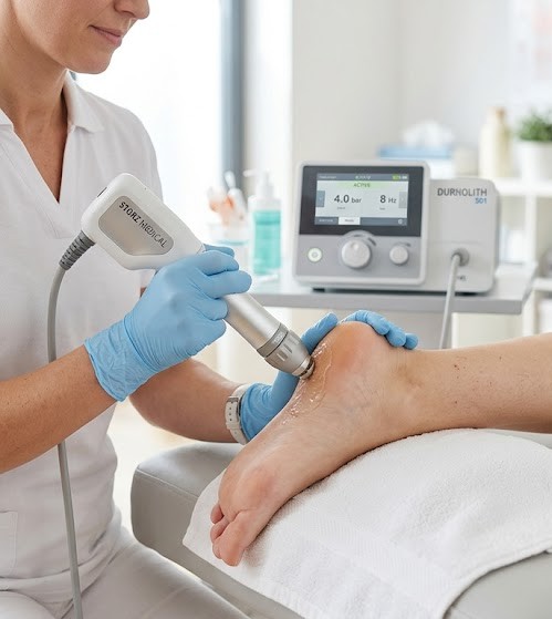 Shockwave therapy applied to the heel for plantar fasciitis